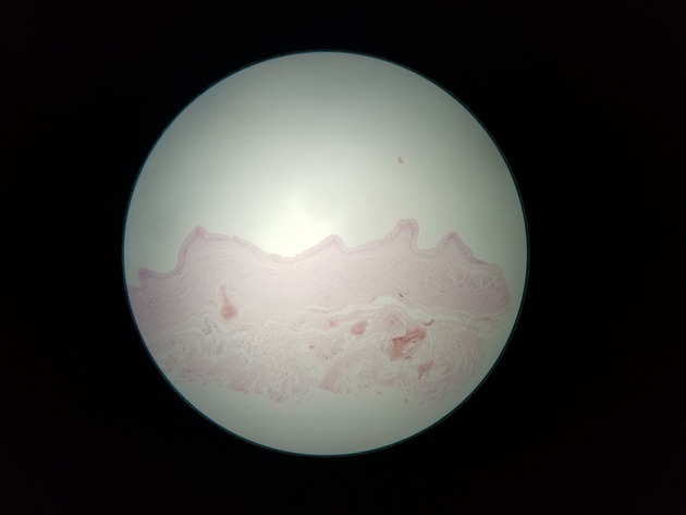 Transitional Epithelium Slides - Transitional Epithelium 01 40X